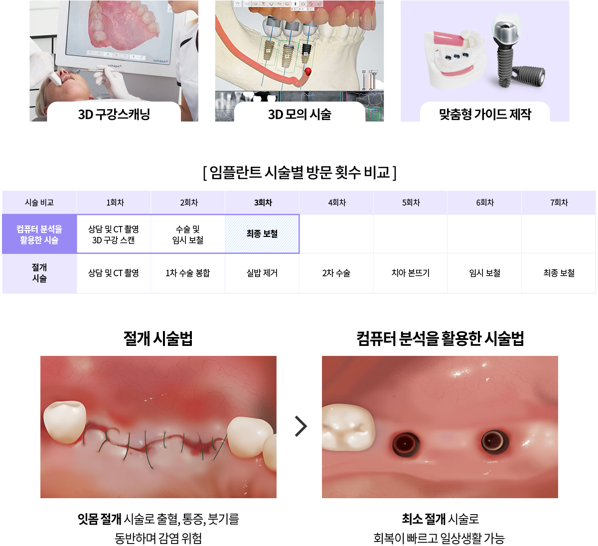 3D 내비게이션 임플란트 특징
