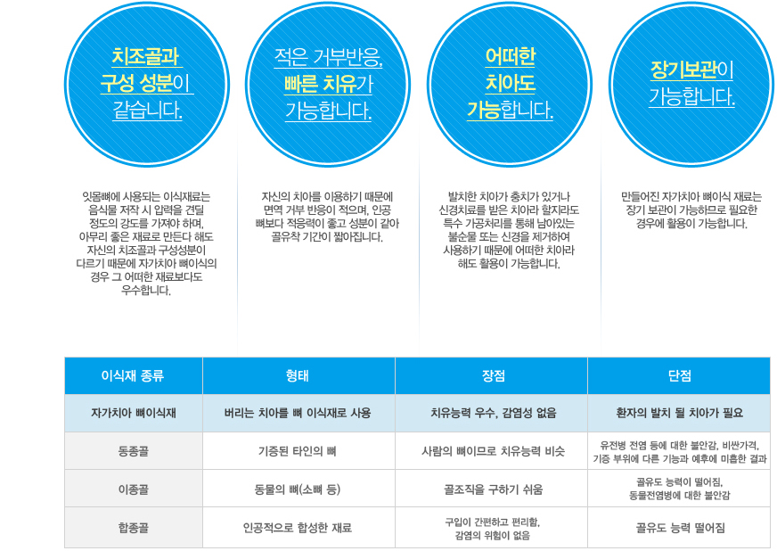 대전자가치아뼈이식의 장점