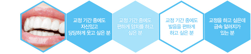 대전투명교정의 장·단점