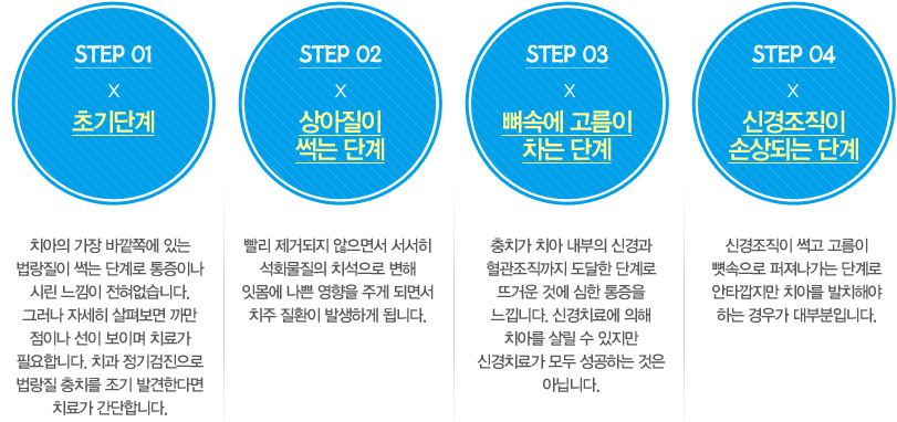 대전충치 진행단계