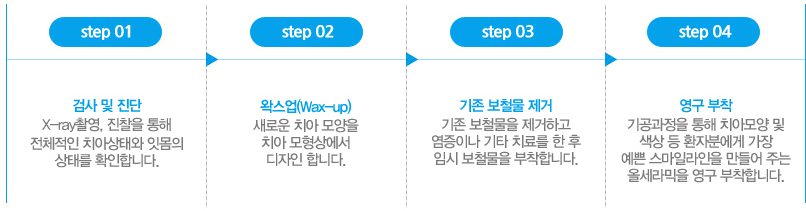 대전올세라믹 치료과정