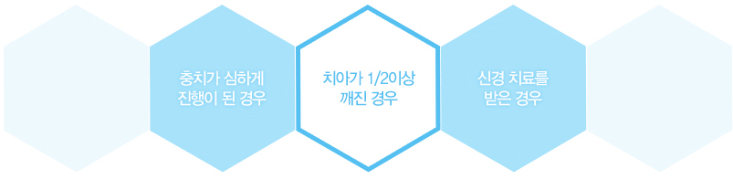 대전크라운이 필요한 경우