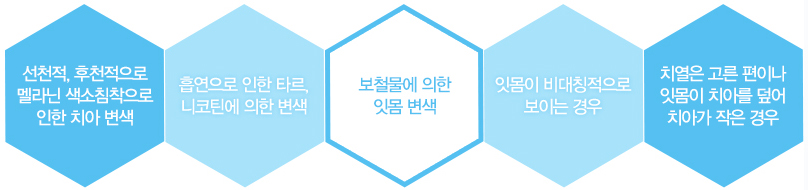 대전잇몸성형이 필요한 경우