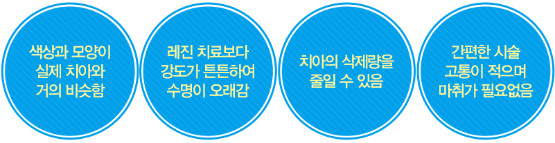 대전라미네이트 장점