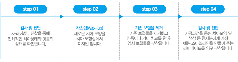 대전무삭제 라미네이트 치료과정