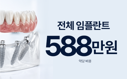 대전 전체임플란트 588만원