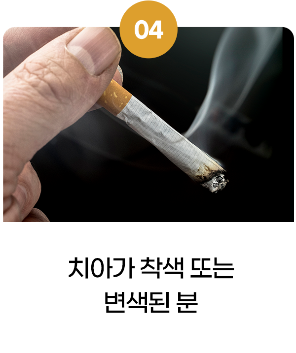 치아가 착색 또는 변색된 분