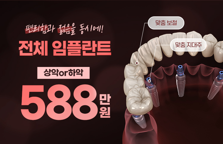 대전임플란트 전체임플란트 비용 588만원