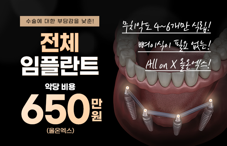 대전임플란트 전체임플란트 비용 650만원